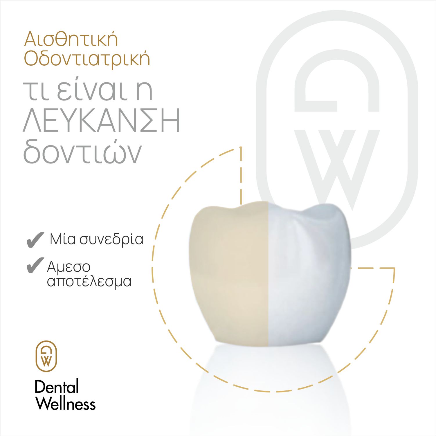 λεύκανση δοντιών