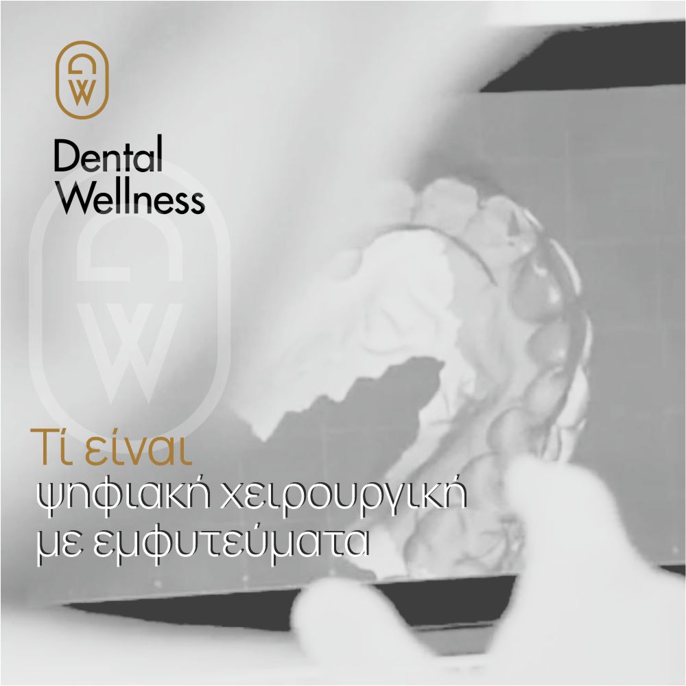 Τι είναι Ψηφιακά καθοδηγούμενη  τοποθέτηση εμφυτευμάτων δοντιών